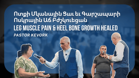 Ոտքի Մկանային Ցաւ եւ Գարշապարի Ոսկրային Աճ Բժշկուեցան. Բժշկութեան Վկայութիւններ Մեծամորի Եկեղեցիէն